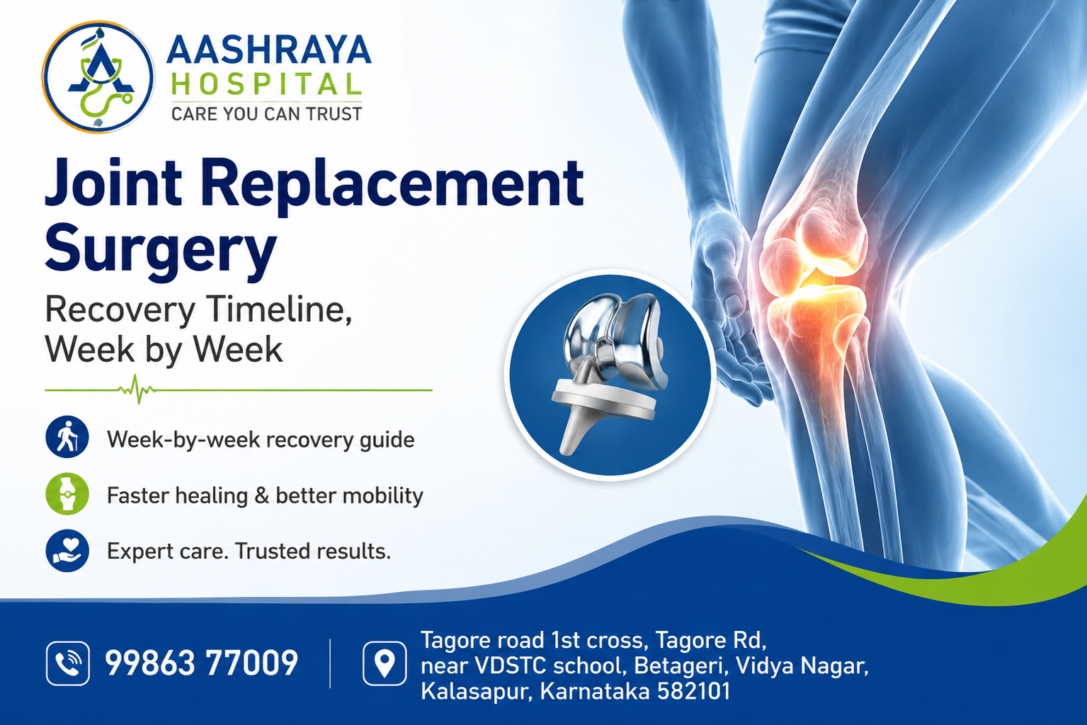 Joint Replacement Surgery: Recovery Timeline, Week by Week