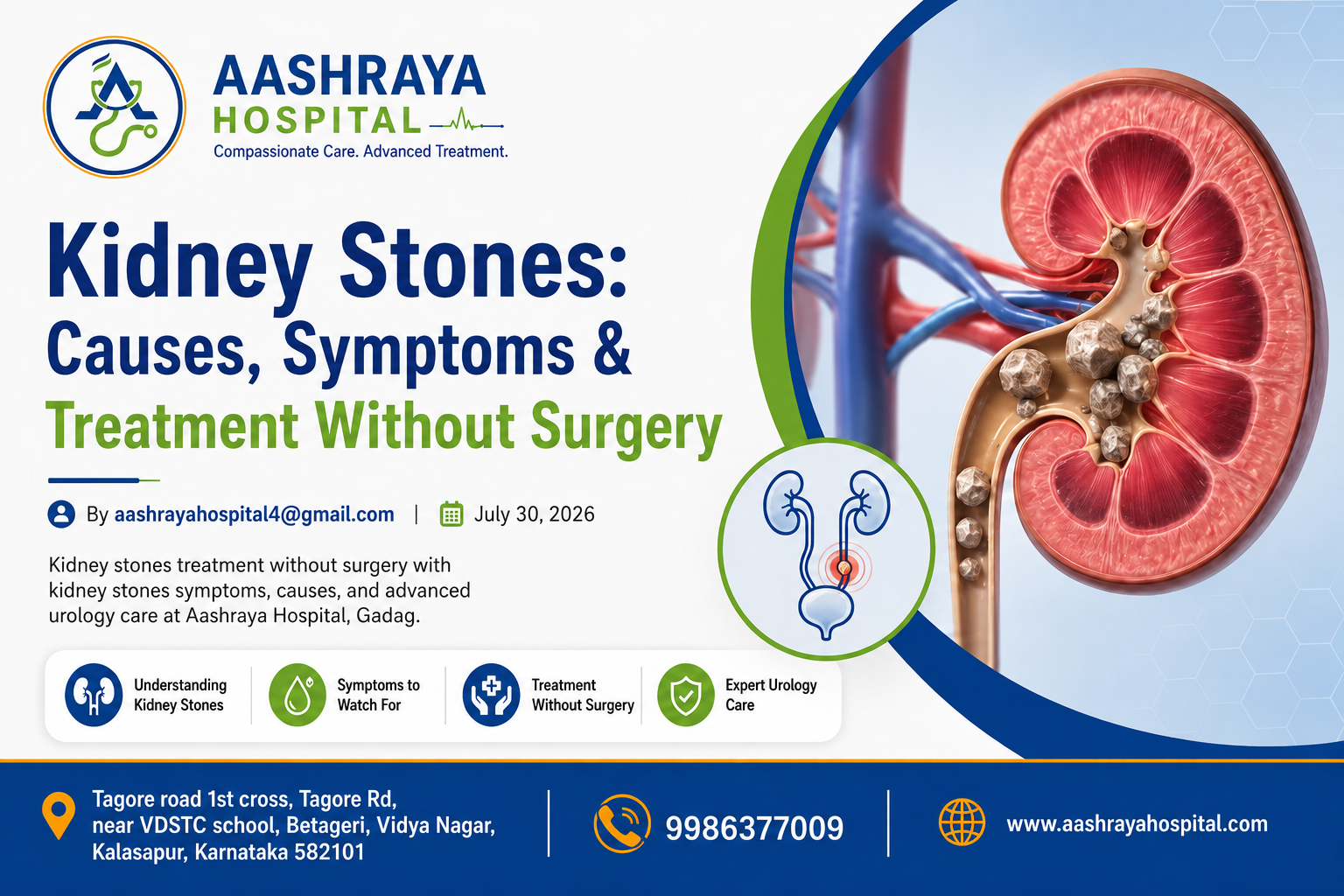 Kidney Stones: Causes, Symptoms & Treatment Without Surgery